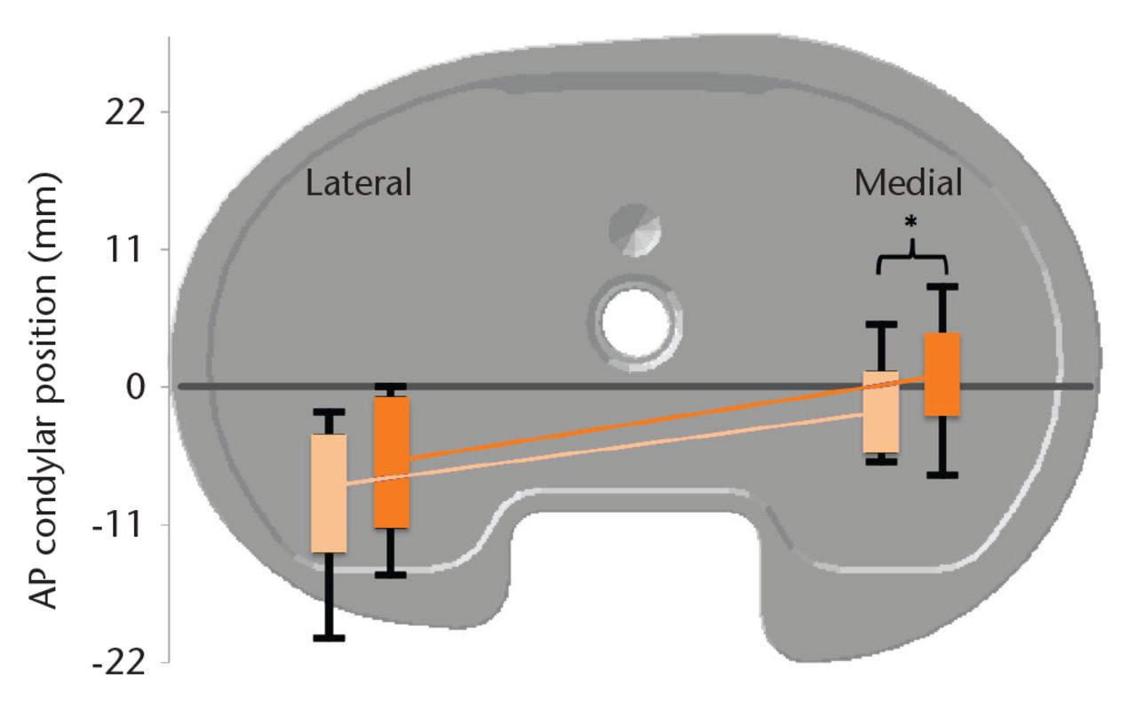 Fig. 2 
            The femoral condyles show an externally rotated orientation in maximum flexion during lunging (light orange) and kneeling (dark orange) activities. Mean condylar position is indicated by the light and dark orange lines, the colour-filled rectangles show the one standard deviation, and the black bars indicate the extreme range for all knees in the cohort. All translations were normalised to a medium-sized tibial baseplate and referenced to a medial/lateral line (grey) passing through the deepest point of the tibial insert concavity and parallel to the posterior baseplate notch. Normalised medial condylar position was more posterior during lunging than during kneeling activities (t-test, p = 0.04). (AP, anteroposterior).
          
