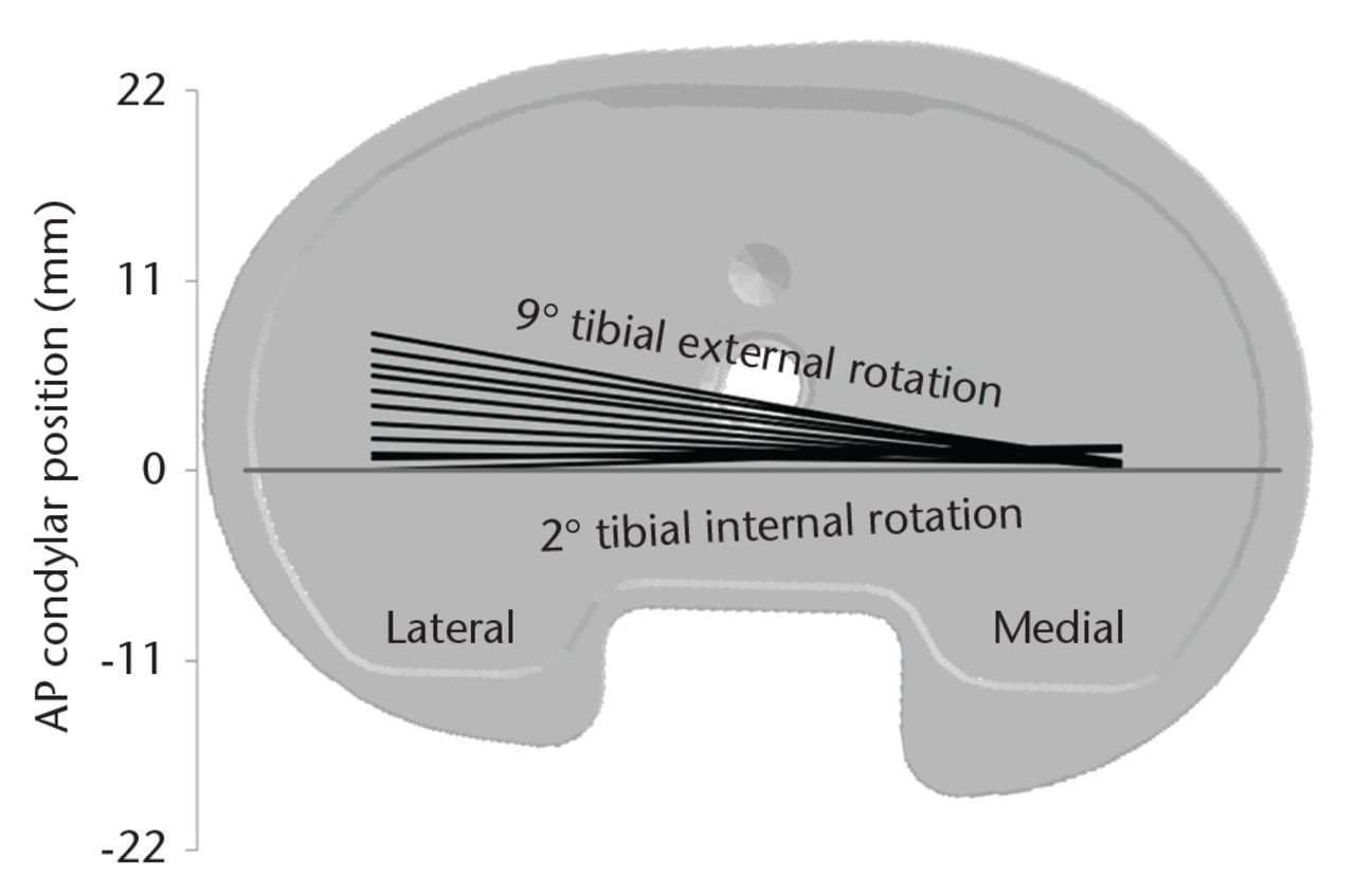 Fig. 5 
            Femoral translations during pivoting activity show predominantly lateral condylar movement about a stationary medial condyle. This diagram superimposes mean locations of the lowest condylar points onto a medium-size baseplate (AP, anteroposterior).
          