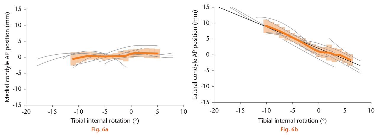  
            During pivoting activity, there was little medial condylar translation (a) and lateral condylar translation (b) was linearly related to tibial rotation (R2 = 0.98). The thick orange line shows the group mean, the shaded orange area represents one standard deviation, and the thin grey lines are data for individual knees. Positive values in each graph represent an anterior translation with negative values showing a posterior position (AP, anteroposterior).
          