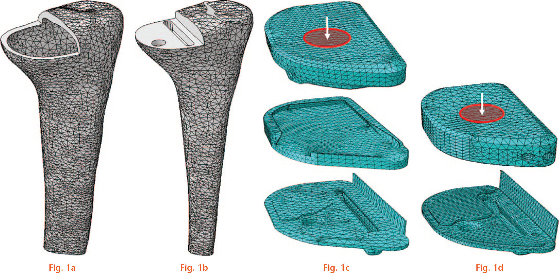  
          The finite element model: a) cortical bone part; b) cancellous bone part; c) metal-backed implant (polyethylene, metal tray) and cement meshes; and d) all-polyethylene implant and cement mesh. The area of distributed load is highlighted.
        