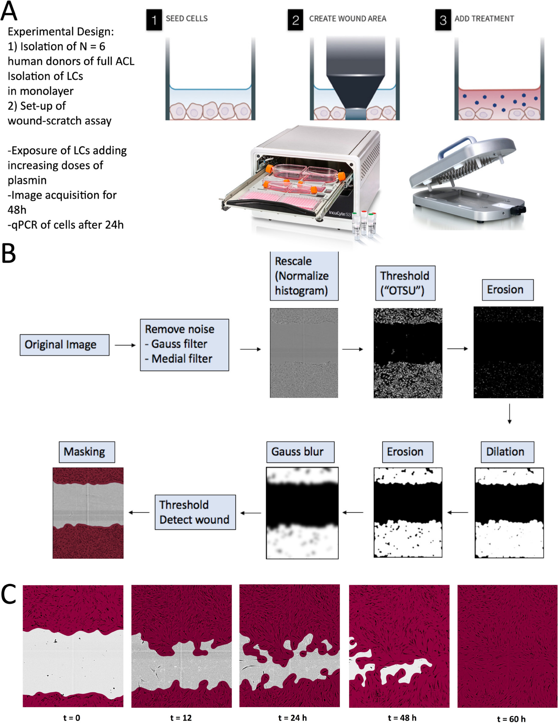 Fig. 2 
            Experiment design of the performed study to test the effect of plasmin, a component of the synovial fluid, on the wound healing behaviour of primary anterior cruciate ligament (ACL)-derived ligamentocytes (ACL-LCs). a) Experiment set-up. b) Customized main image processing chain using open source CellProﬁler software to segment the ACL-LCs and wound closure in the wound scratch assays. "OTSU" refers to the image thresholding algorithm named after Nobuyuki Otsu.16 c) Example of phase-contrast images taken at a 10× magnification with the IncuCyte S3 system demonstrating customized segmentation of ACL-LCs. LC, ligamentocyte; qPCR, quantitative PCR.
          