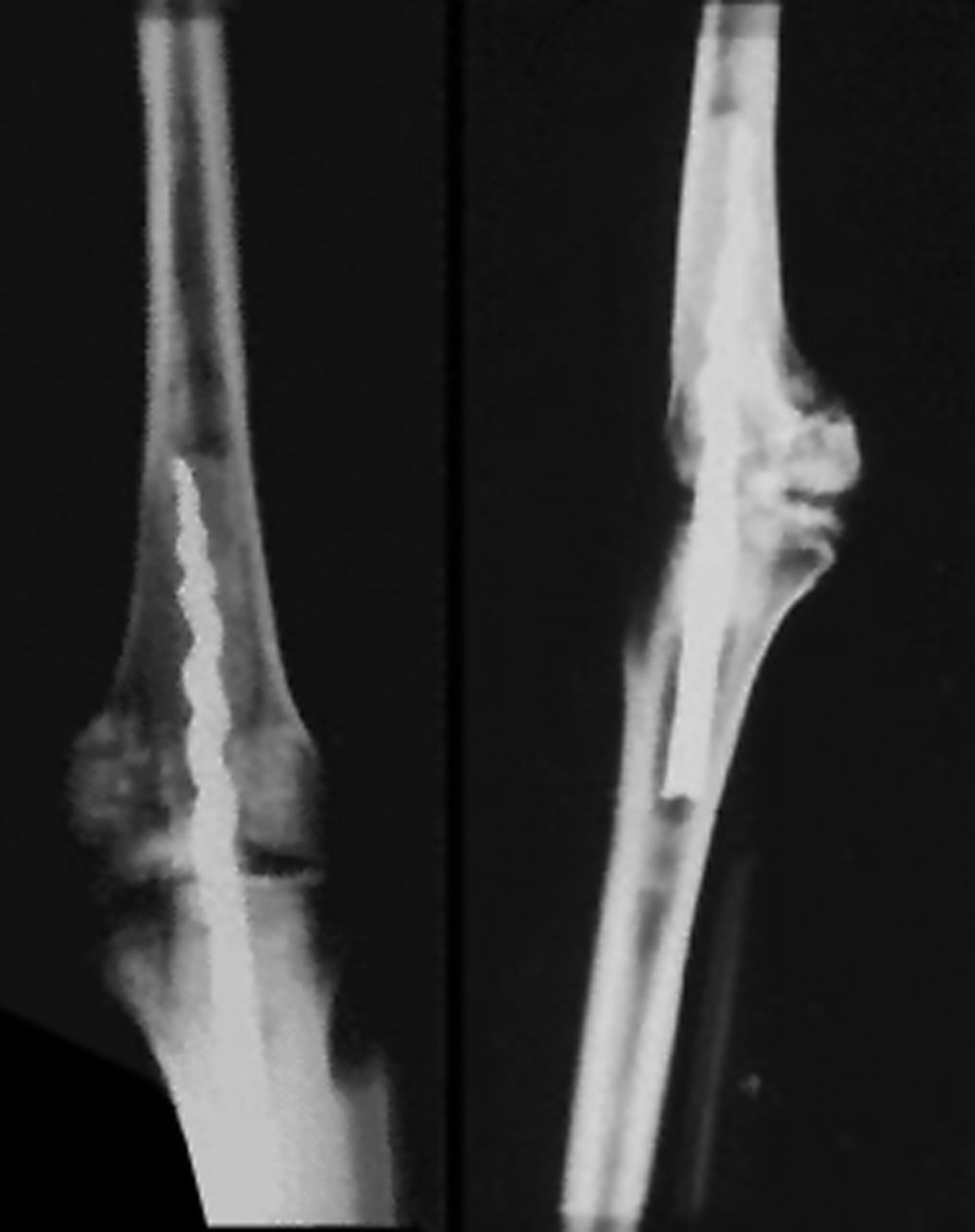 Fig. 5 
          Radiograph of the right knee of the mummy of Usermontu.
        