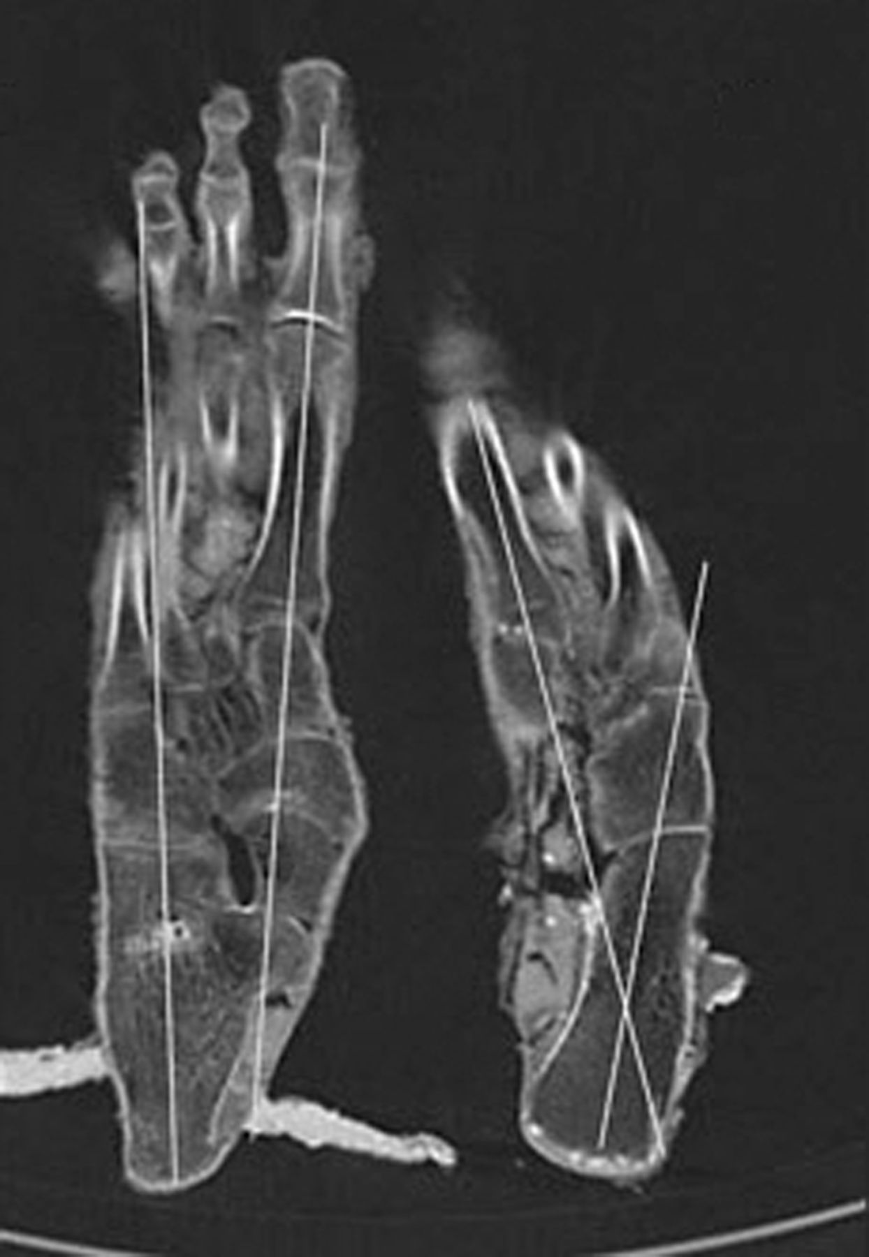 Fig. 6 
          CT scan of Tutankhamun’s feet.
        