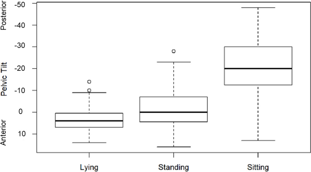 Fig. 4 
          Box plot showing the variability in preoperative lying, standing and sitting pelvic tilt (PT) in patients undergoing total hip arthroplasty. Positive PT indicates posterior PT, while negative indicates anterior PT.
        